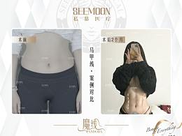 案例