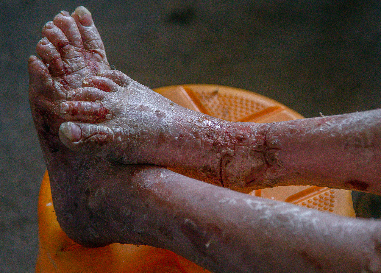 《人鱼天使》纪录片摄像记录