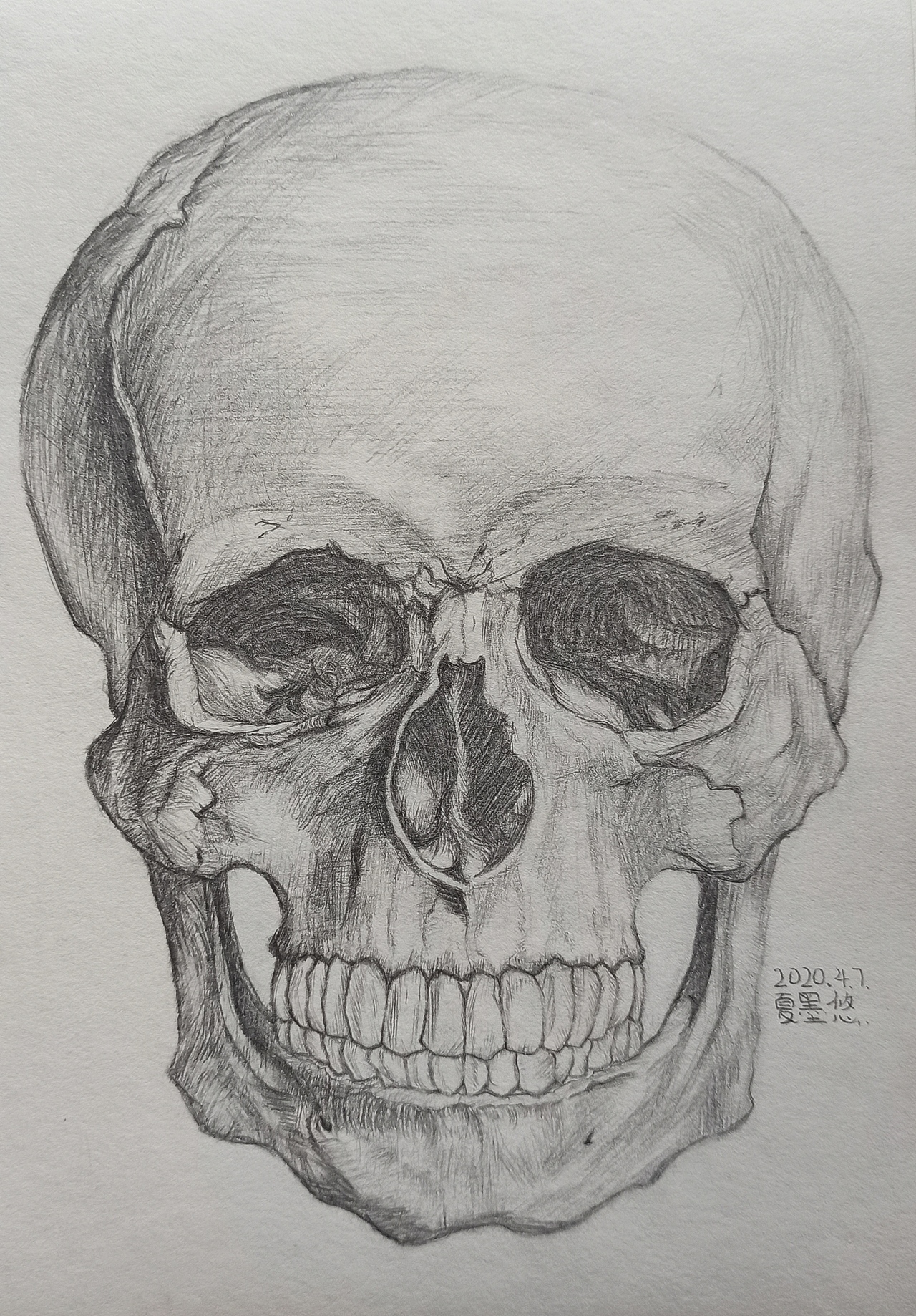 石膏体大集合😝