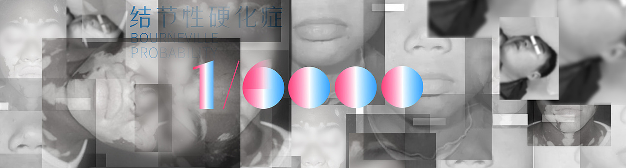 “世界的简单复杂”—关注罕见病，关爱罕见病患者（图ZMjg0NzA5OTMy） - 海报 - 站酷设计师Jungle8998原创素材 - 站酷ZCOOL