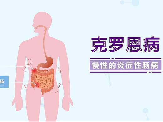 MG动漫科普知识医学常识动画视频宣传片制作闪狼案例展