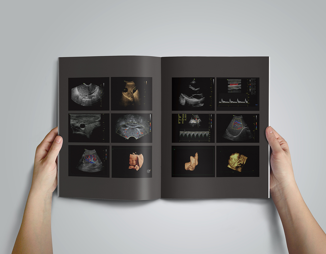 超声画册（图ZOTYzOTIwNDQ=） - 书籍/画册 - 站酷设计师ev红袖en_533原创素材 - 站酷ZCOOL