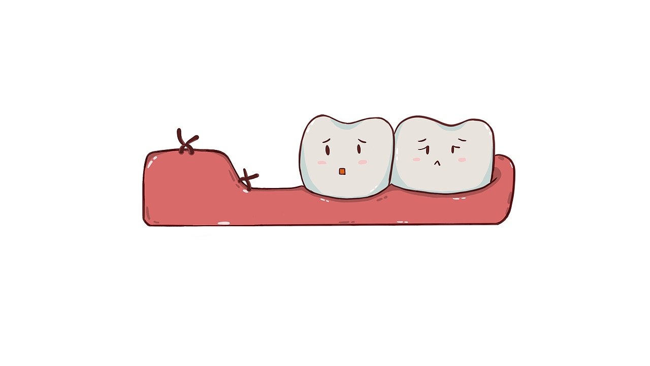 拔智齿流程（图ZMTgyNzE0MTE2） - 艺术插画 - 站酷设计师刘玉美口腔插画原创素材 - 站酷ZCOOL