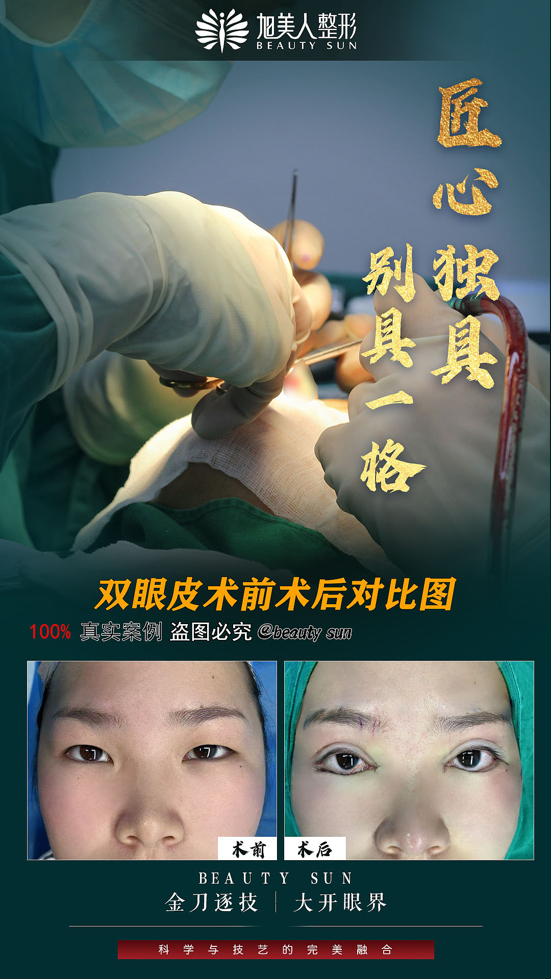 旭美人案例图