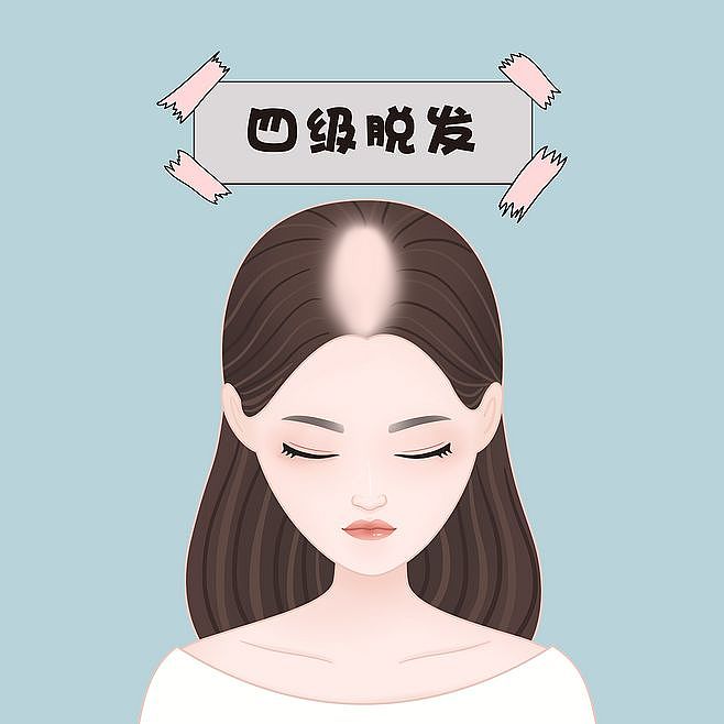 脱发、头部（图ZMTg0NTI2Mzg4） - 创作习作 - 站酷设计师插画人生原创素材 - 站酷ZCOOL