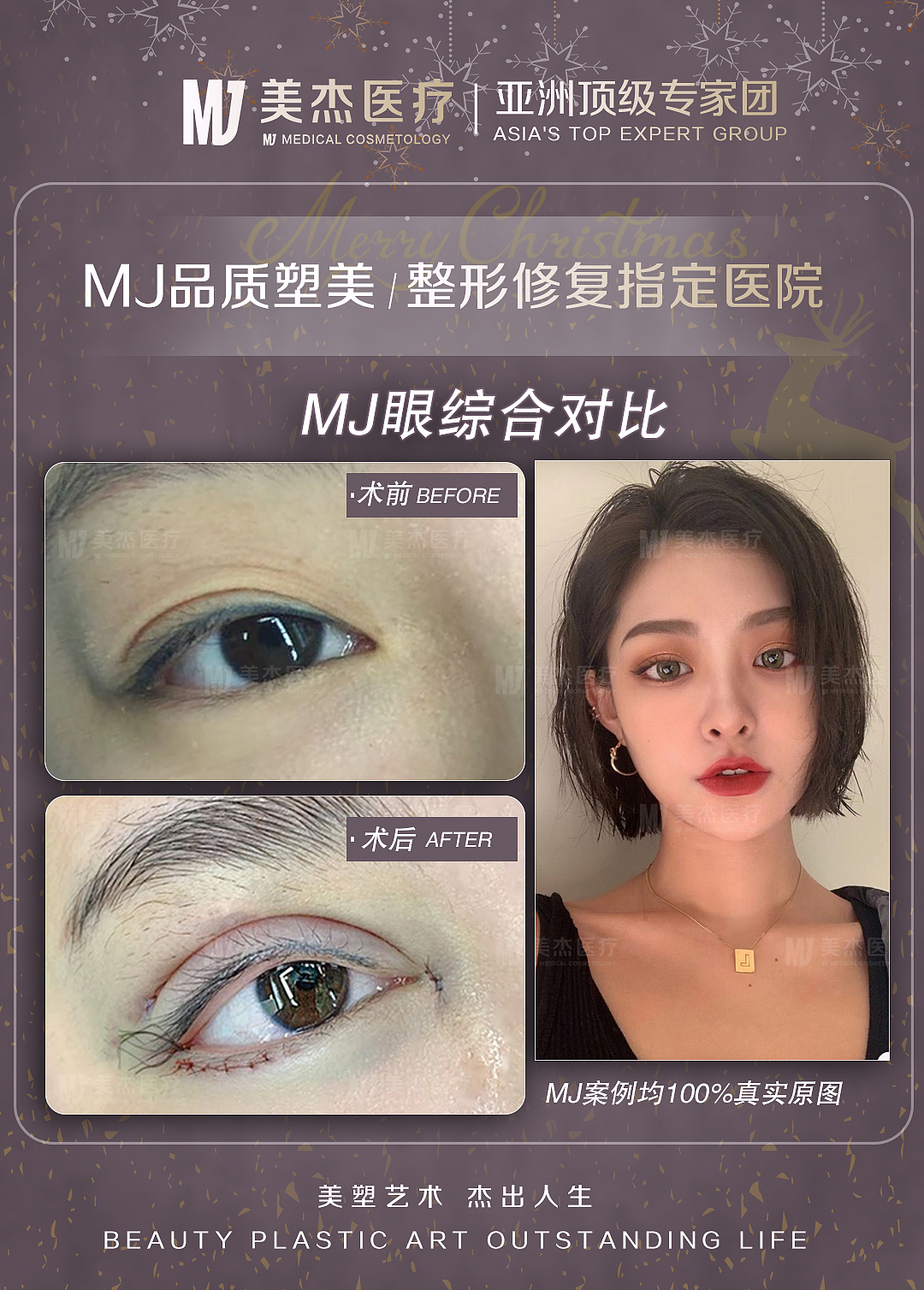 医美（图ZMTkwMjI1OTI0） - 海报 - 站酷设计师Riose原创素材 - 站酷ZCOOL