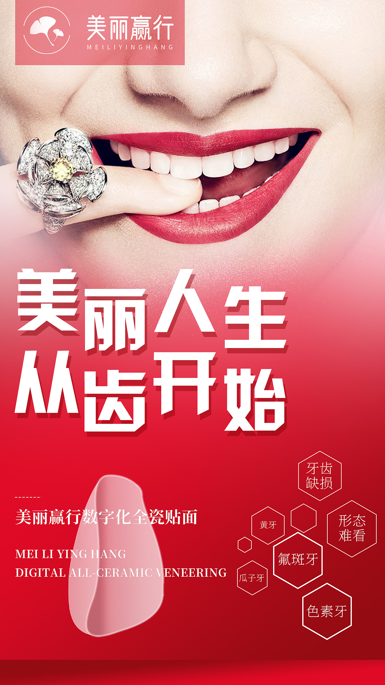 全瓷贴面宣传系列海报