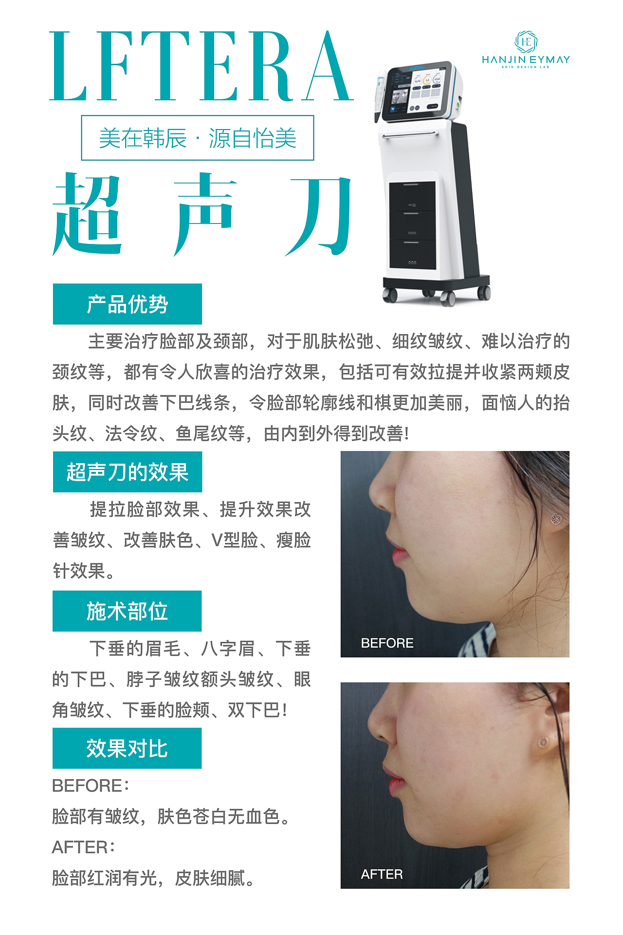 医美海报，易拉宝，册子排版等平面图（图ZMTI4NzQ2MTgw） - 海报 - 站酷设计师渝中至尊宝原创素材 - 站酷ZCOOL