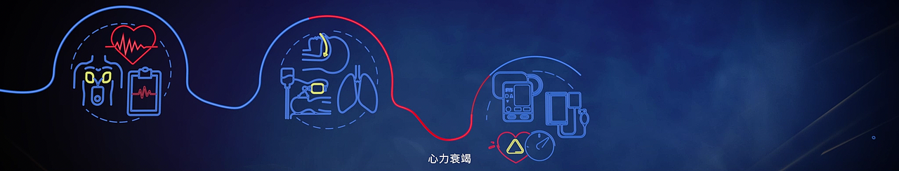 Medtronic 20周年开场视频（图ZMzMxNTU0MDg4） - 产品 - 站酷设计师吃饭睡觉打豆豆O原创素材 - 站酷ZCOOL
