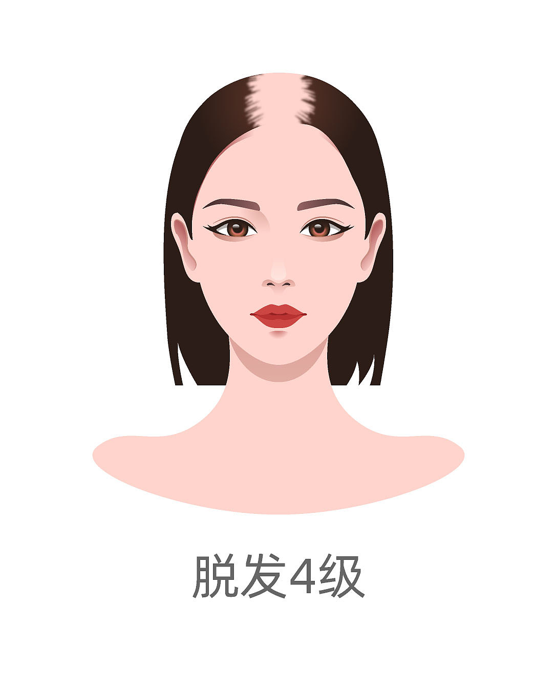 种植毛发（图ZMzA4MjQ2NTMy） - 商业插画 - 站酷设计师蜀文途话原创素材 - 站酷ZCOOL