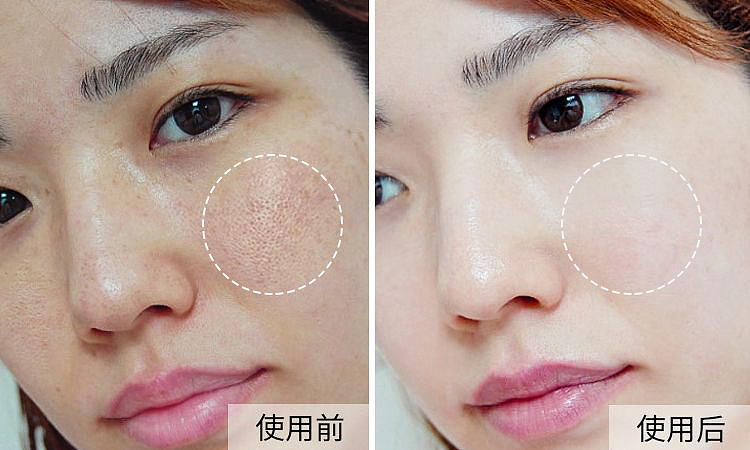 对比图（图ZMjQzNTM2MzYw） - 其他平面 - 站酷设计师酷酷的小5大大原创素材 - 站酷ZCOOL