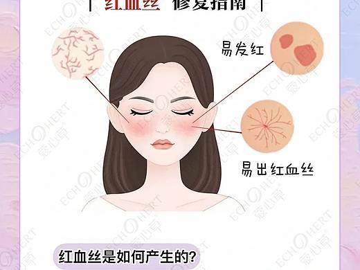蔻心草护肤小知识：如何快速摆脱红血丝