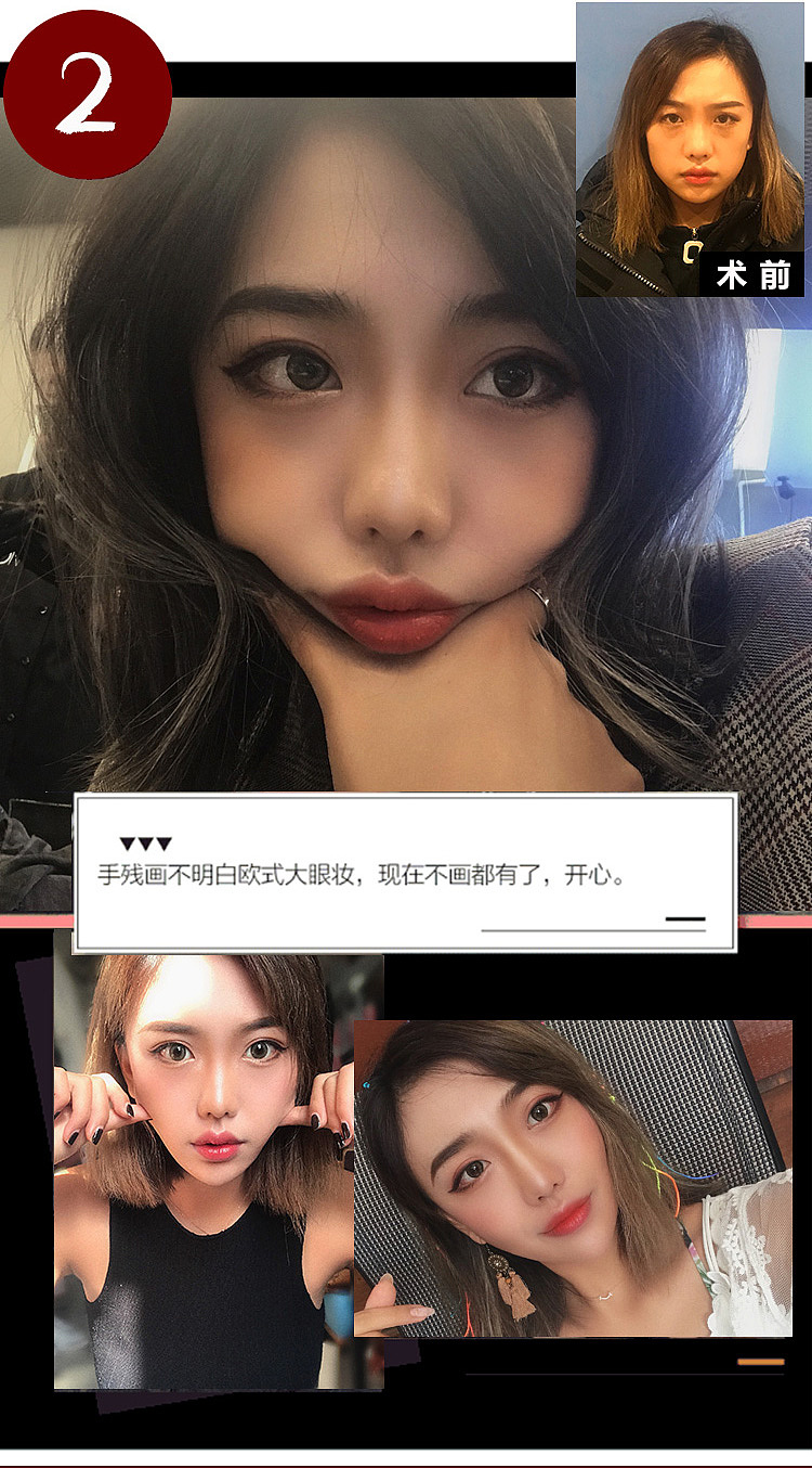 新氧新版详情页（图ZMTU4MDIwMzU2） - 海报 - 站酷设计师叫我小可乐吧原创素材 - 站酷ZCOOL