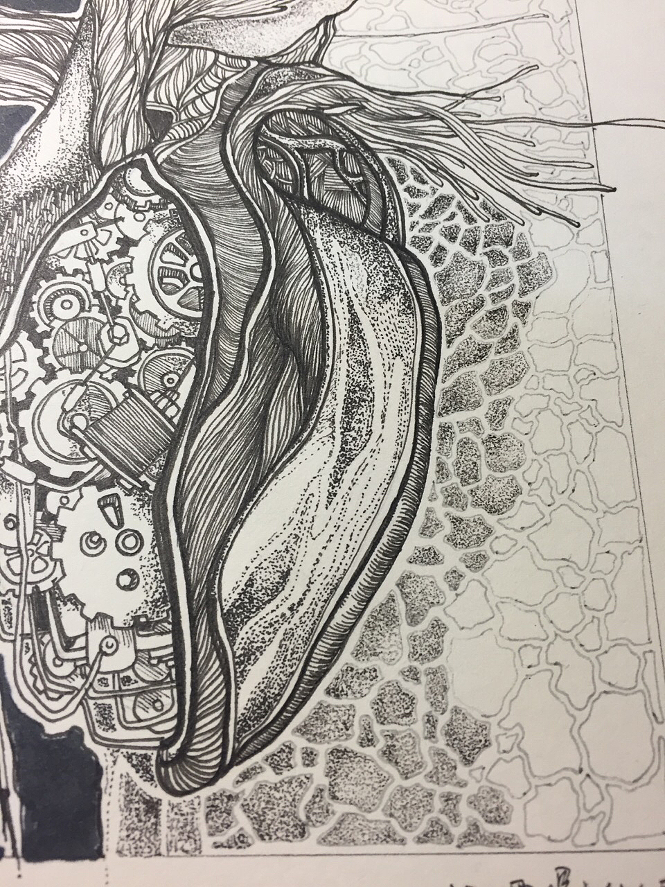 缺了颗螺丝的心脏