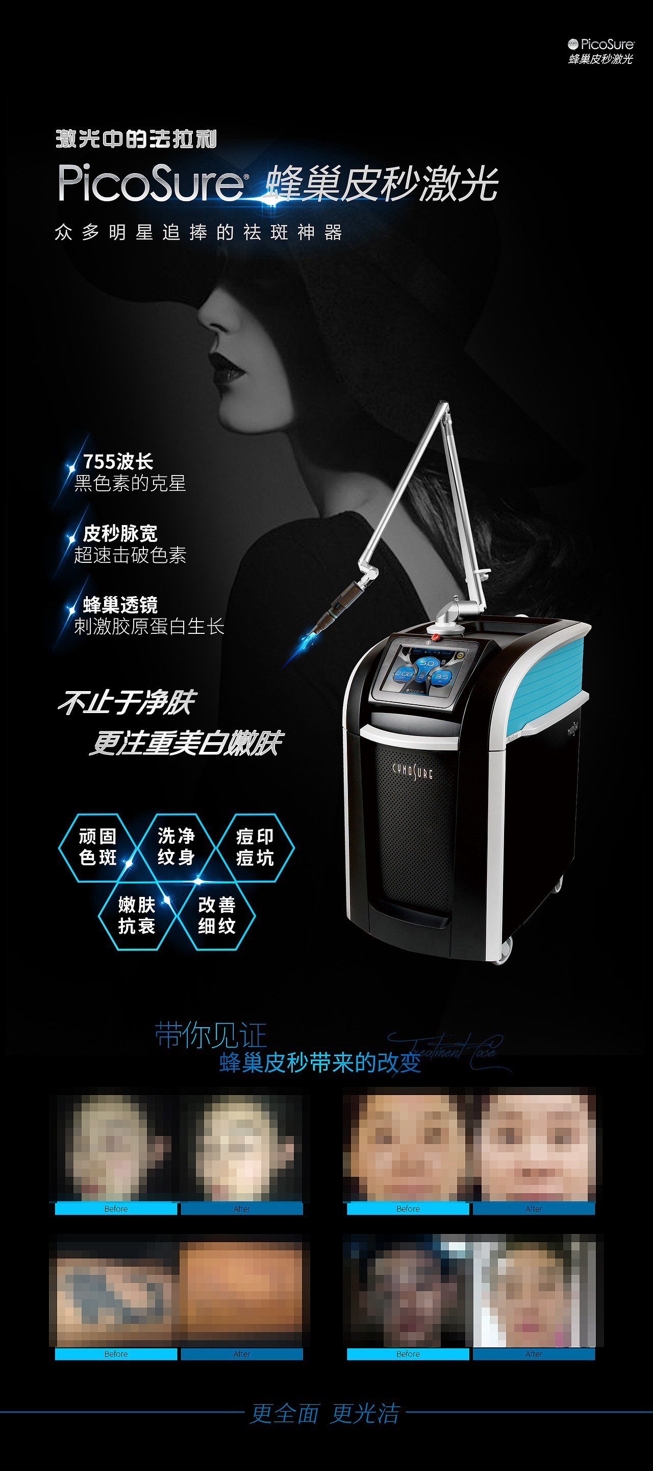 医美蜂巢皮秒海报