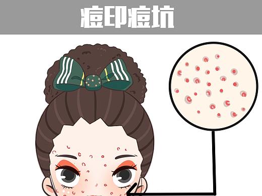 八大肌肤问题