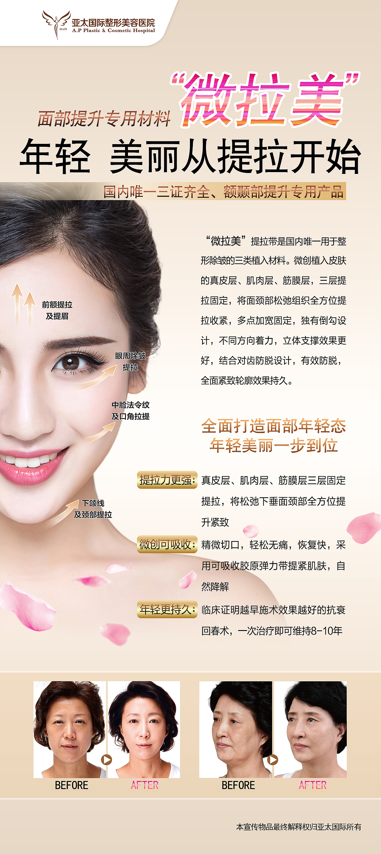 医美项目包装：展架设计（图ZNTU2MDk4NjA=） - 宣传物料 - 站酷设计师是舒舒不是叔叔原创素材 - 站酷ZCOOL