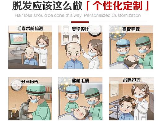 植发，脱发