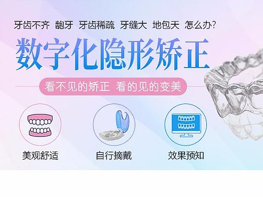数字化隐形矫正