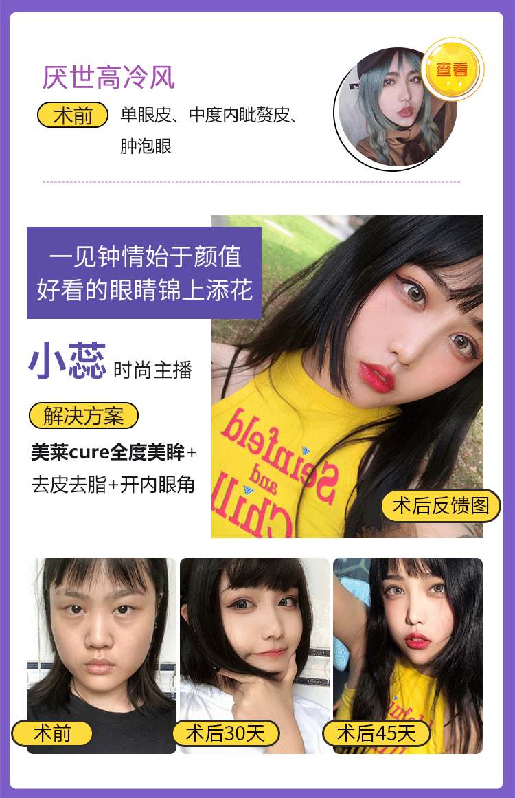 详情页活动版块