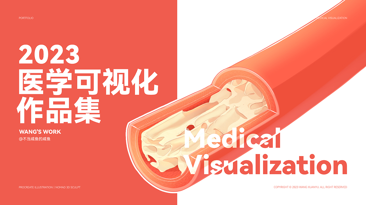 2023医学可视化作品合集（图ZMzU5MjAzMzgw） - 创作习作 - 站酷设计师不当咸鱼的咸鱼原创素材 - 站酷ZCOOL
