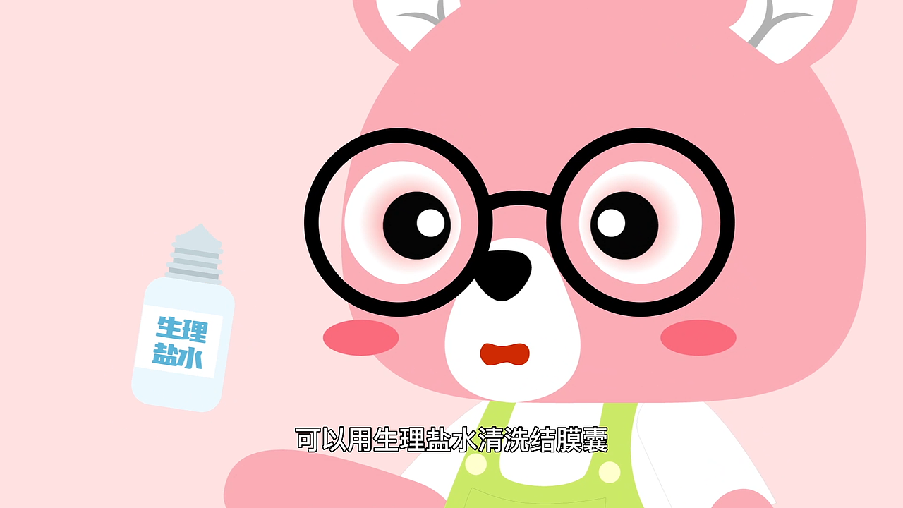 小动画 | 春季护眼小知识——过敏性结膜炎