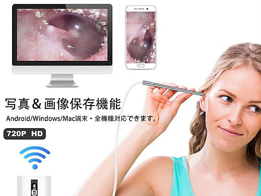 耳道内窥镜