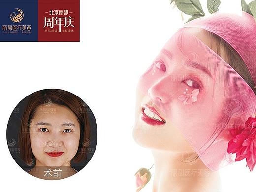 曹卫华：为什么要选择PARK重脸术