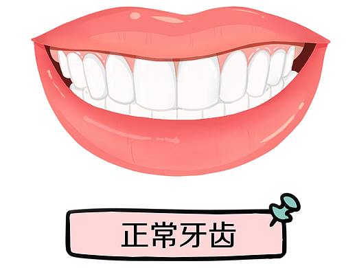 牙齿八大问题