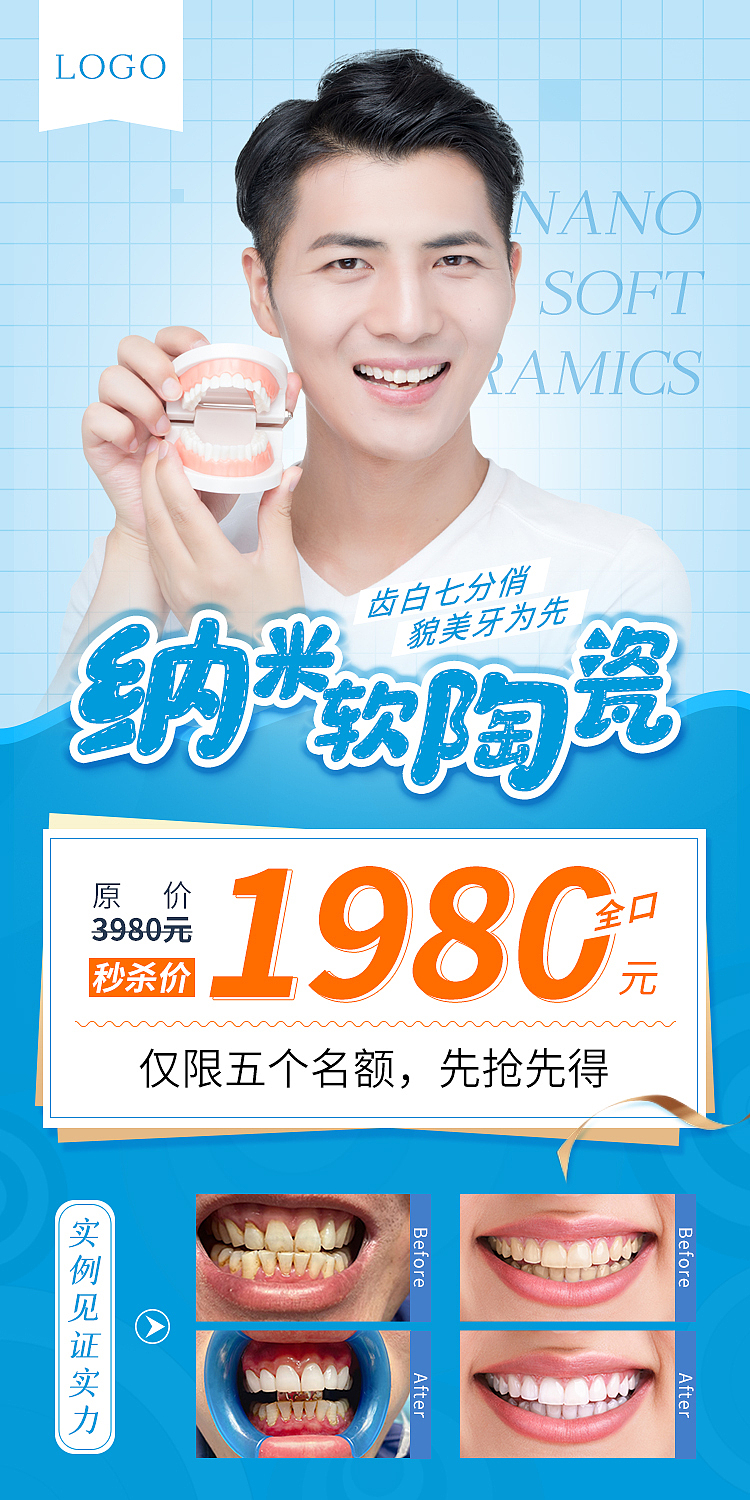 纳米软陶瓷牙海报