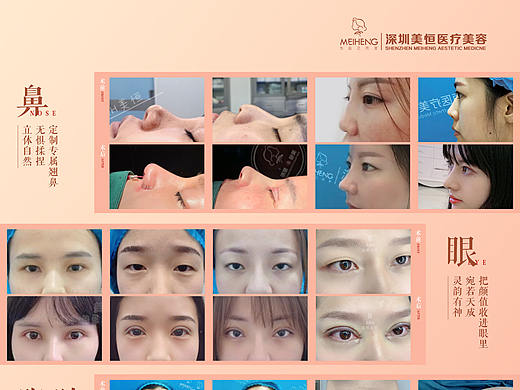 医美·案例对比海报