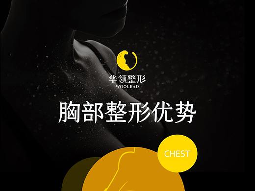 胸部优势
