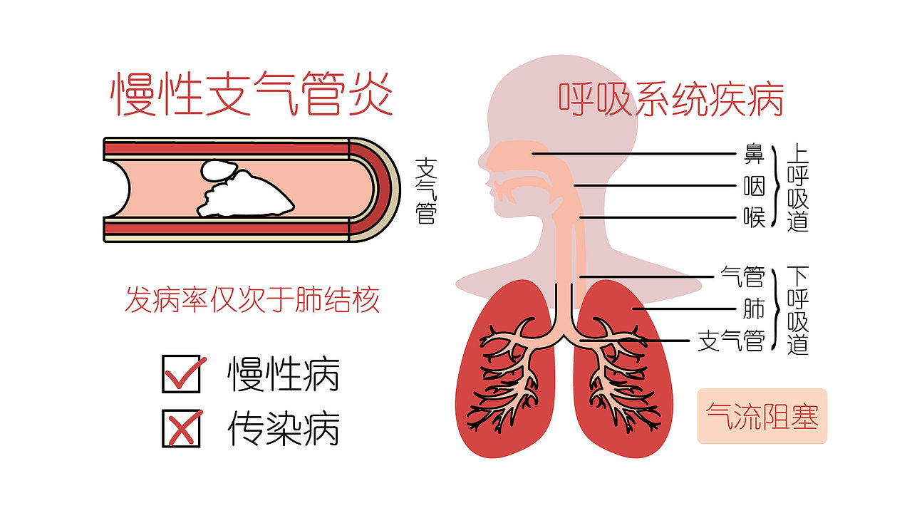 肺腑之言：慢性支气管炎发病率仅次于肺结核，不可小视（图ZMjAzMTM5MzA0） - 其他动漫 - 站酷设计师解渴果原创素材 - 站酷ZCOOL