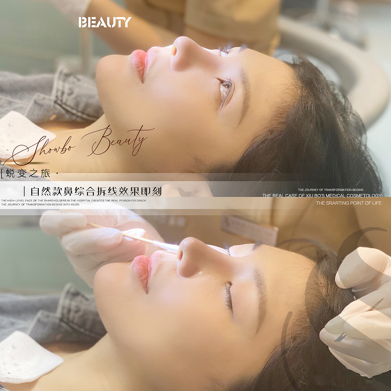 醫(yī)美整形案例分享（圖ZMjk5OTUzNDg0） - 海報 - 站酷設計師MMMMMM黃原創(chuàng)素材 - 站酷ZCOOL