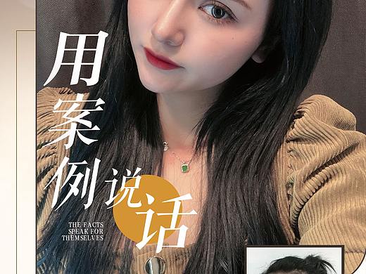 医美案例对比展板