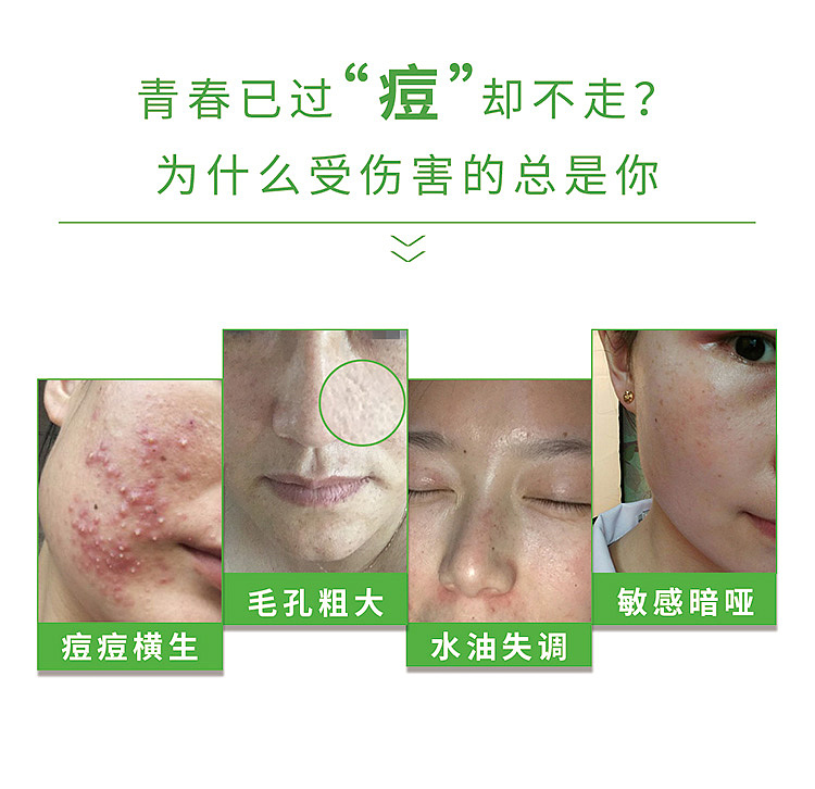 清克植萃祛痘柔肤精华水（图ZMjAwMzc1Njg4） - 企业官网 - 站酷设计师清克原创素材 - 站酷ZCOOL