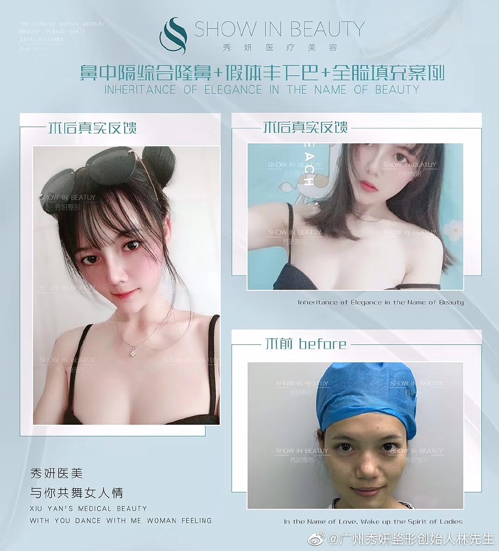 整形案例-品牌定制风