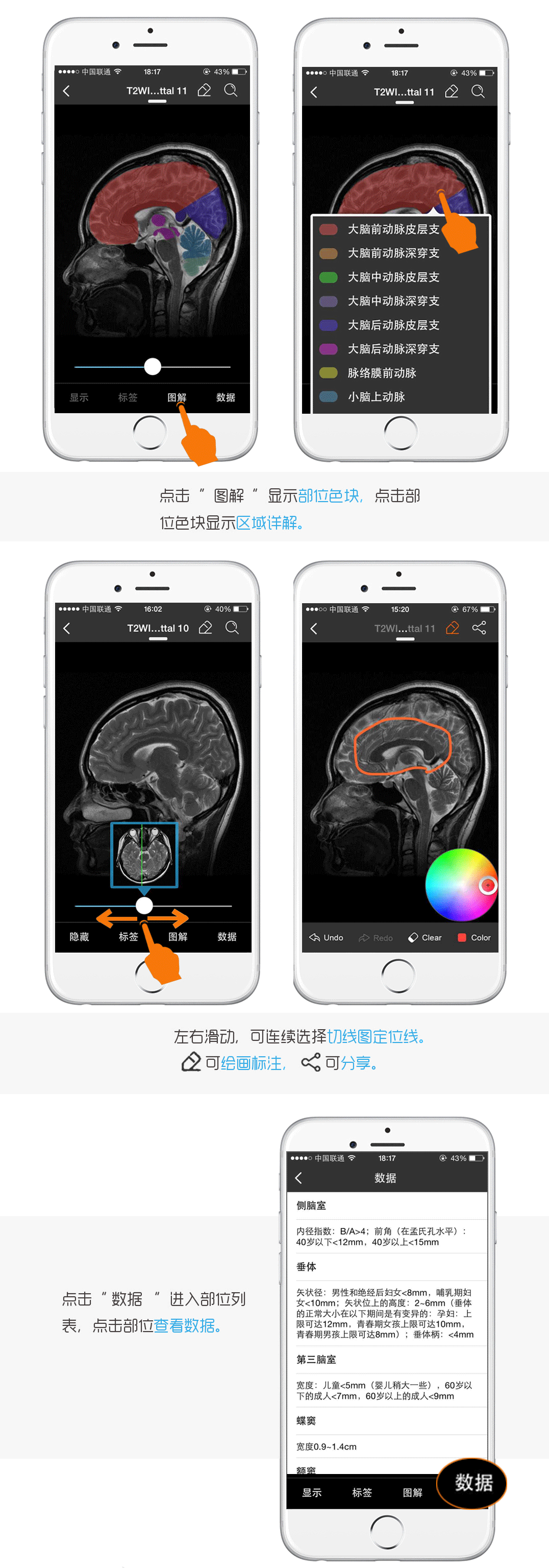APP的使用说明（图ZMzI5NTMyMzI=） - 书籍/画册 - 站酷设计师beilaiart原创素材 - 站酷ZCOOL