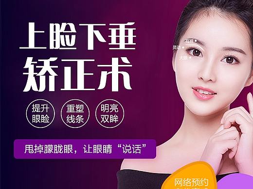 上睑下垂矫正术-WAP专题