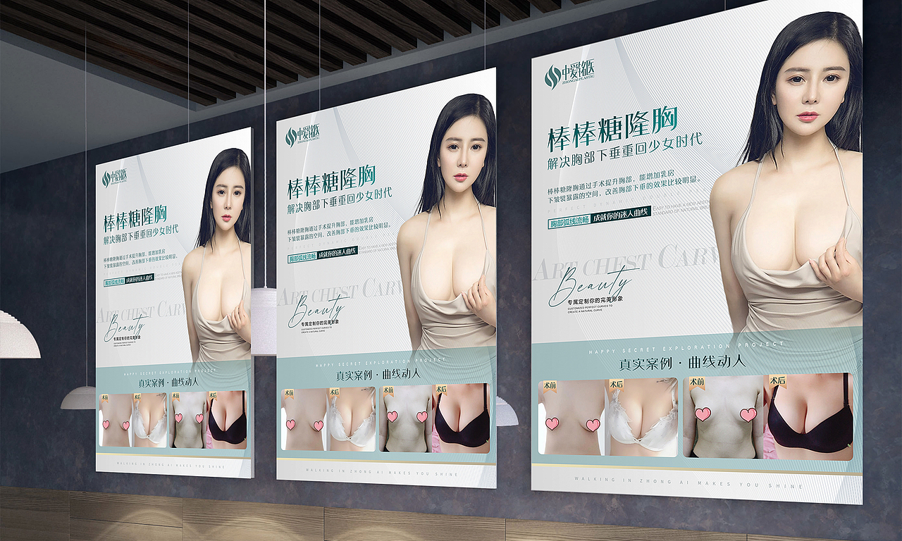整形医疗美容案例海报医美项目案例展板展架KT板（图ZMjU4NTQ5Nzky） - 海报 - 站酷设计师是杯酒是咖啡原创素材 - 站酷ZCOOL