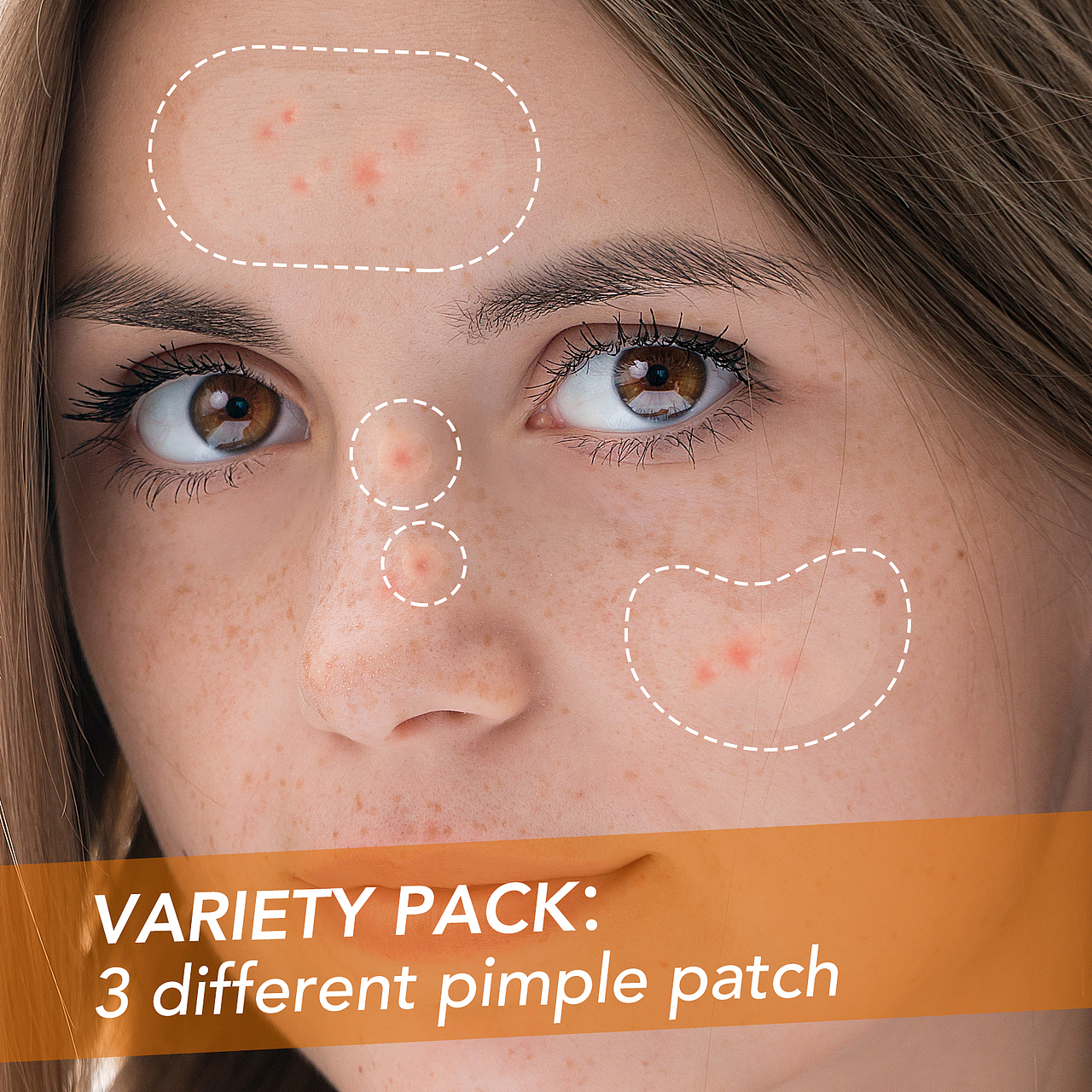 痘痘贴合集（图ZMzA1Mzc1ODI0） - 其他平面 - 站酷设计师偲酷摄影设计原创素材 - 站酷ZCOOL