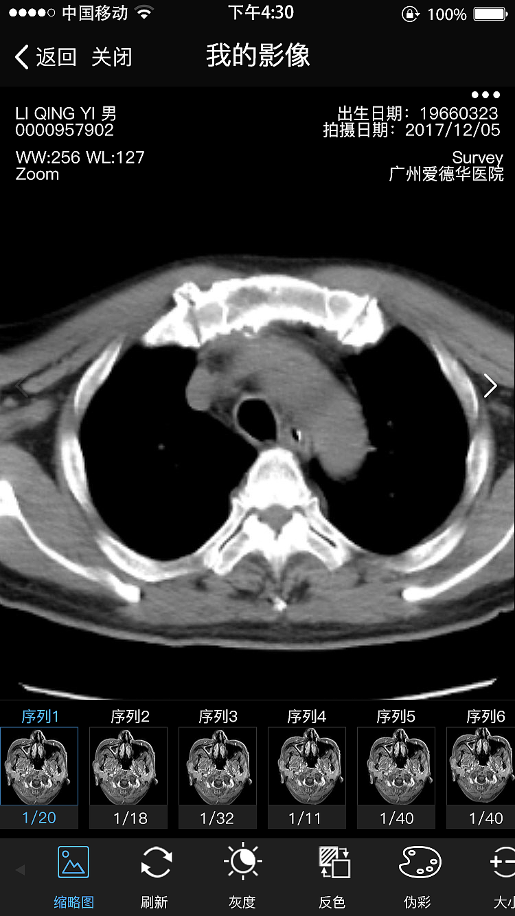 医疗影像h5页面设计