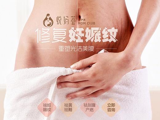 整形美容——产后修复