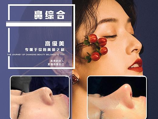 整形案例医美对比图