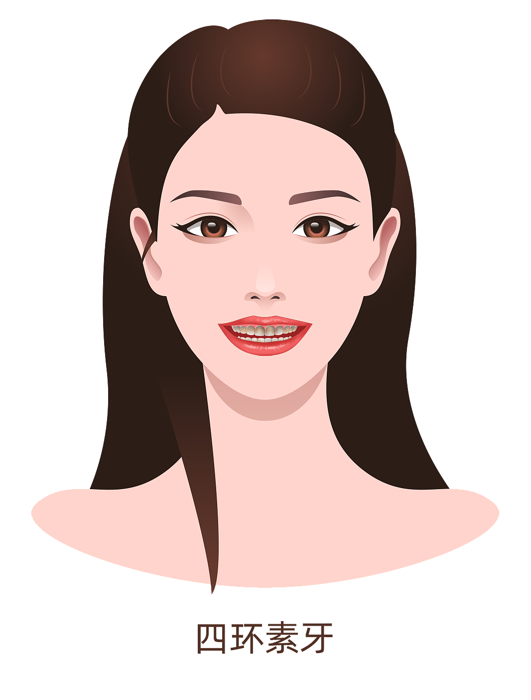 多生牙、氟斑牙、黄牙、四环素牙、牙结石（图ZMzA4MjU0NjM2） - 商业插画 - 站酷设计师蜀文途话原创素材 - 站酷ZCOOL