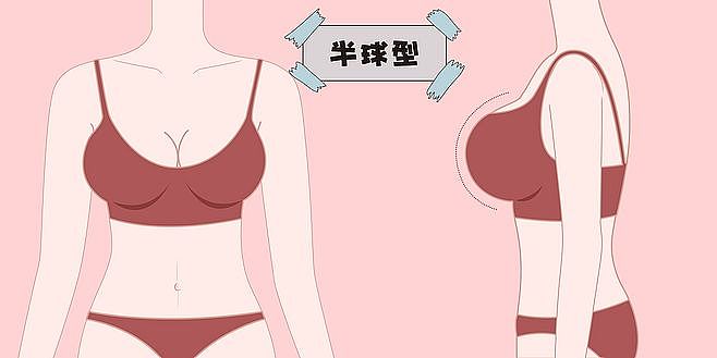 医美胸部、胸型（图ZMTg0NTI4NjIw） - 创作习作 - 站酷设计师插画人生原创素材 - 站酷ZCOOL