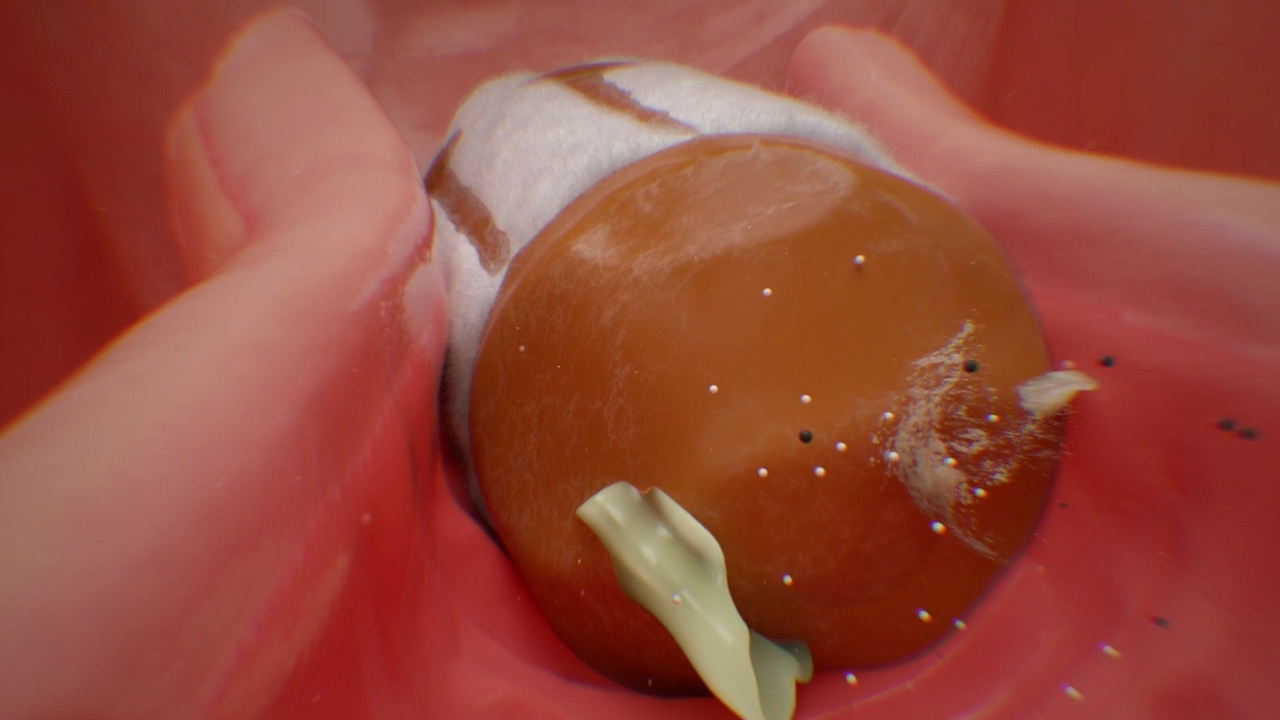 医学医疗原理动画展示-医疗动画制作公司