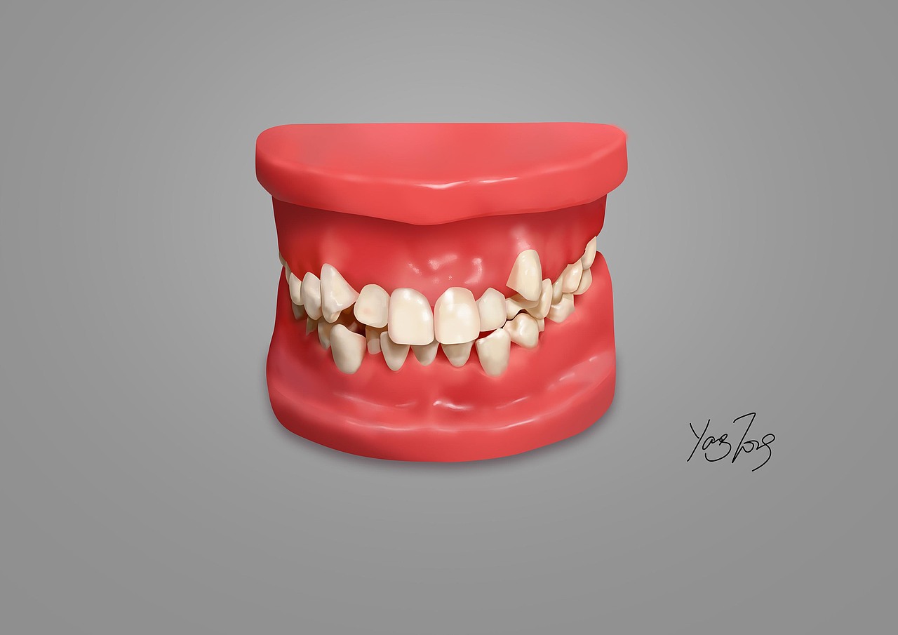 牙列模型手繪（圖ZMzExOTExODEy） - 創(chuàng)作習作 - 站酷設計師MISS歐原創(chuàng)素材 - 站酷ZCOOL