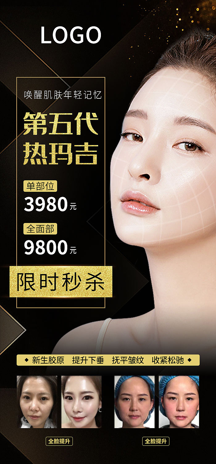 医美海报-热玛吉