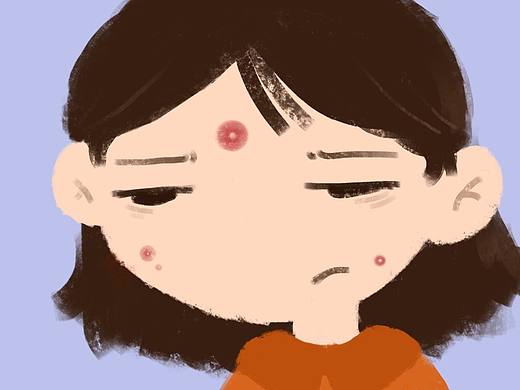 不合时宜的痘痘26/100